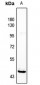 Anti-HORMAD1 Antibody