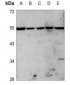 Anti-PLK5 Antibody