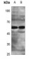 Anti-ZNF280A Antibody
