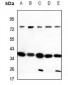 Anti-CD200R Antibody