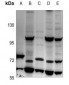 Anti-IL-31RA Antibody