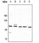 Anti-SYNE3 Antibody