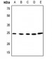 Anti-APOBEC3A Antibody