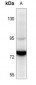 Anti-SENP5 Antibody