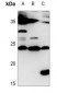 Anti-IL-28A Antibody