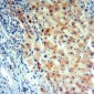 Anti-Angiopoietin-2 Antibody