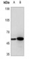 Anti-Angiopoietin-2 Antibody