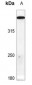 Anti-ATM (pS1987) Antibody