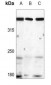 Anti-ATM Antibody