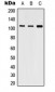 Anti-SERCA2 Antibody