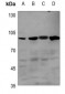 Anti-BMPR2 Antibody