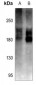 Anti-Cav1.2 Antibody