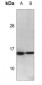 Anti-Calcitonin Antibody