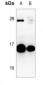 Anti-GM-CSF Antibody