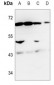 Anti-NRG1 Antibody