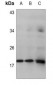 Anti-HMGA1 Antibody