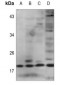 Anti-IL-2 Antibody