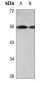 Anti-CD181 Antibody