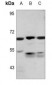 Anti-PKLR Antibody