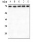 Anti-RPA1 Antibody