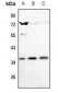 Anti-SLUG Antibody