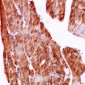 Anti-SPARC Antibody