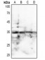 Anti-SPARC Antibody