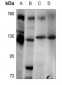 Anti-Telomerase Antibody