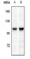 Anti-TRPV1 Antibody