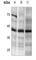 Anti-DR5 Antibody