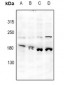 Anti-JIP4 Antibody