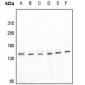 Anti-LATS1 Antibody