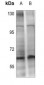 Anti-CHK2 (pT432) Antibody