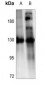 Anti-ZO3 Antibody