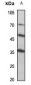 Anti-MINA53 Antibody