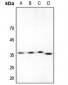 Anti-ACER1 Antibody