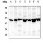 Anti-RGMB Antibody