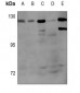 Anti-Androgen Receptor (pS650) Antibody