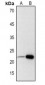 Anti-Adrenomedullin Antibody