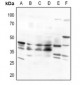 Anti-Beta-3 Adrenergic Receptor Antibody