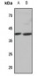 Anti-APJ Antibody