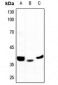 Anti-ALDOB Antibody