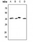 Anti-Aldose Reductase Antibody