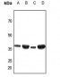 Anti-ANT3 Antibody