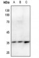 Anti-Annexin A2 (pS26) Antibody