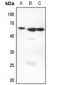 Anti-AIRE Antibody