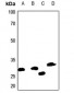 Anti-Aquaporin 1 Antibody