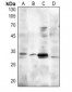 Anti-MASH1 Antibody