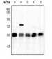 Anti-ATF4 (pS245) Antibody