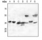 Anti-CD298 Antibody